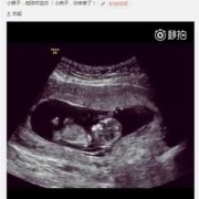 怀孕三个月了，b超显示宝宝偏小，以后会不会有影响,产检胎儿偏小一周怎么办