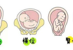头位胎儿（头位胎儿在肚子里的姿势图）
