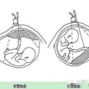 胎儿位于子宫前壁（胎儿位于子宫前壁和后壁有什么区别）