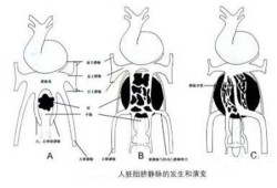 胎儿永久性右脐静脉是什么意思（胎儿永久性右脐静脉是什么意思）