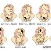 胎儿频繁胎动（感觉一下午都在胎动正常吗）