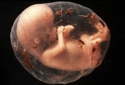 怀孕11周胎儿（刚怀孕十一周胎儿会动了吗?孕妇能感觉到不）