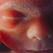 28周的胎儿图片（28周胎儿发育情况是怎样的）