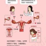 盆腔炎怀孕了对胎儿有影响吗（慢性盆腔炎怀孕了对胎儿有影响吗）