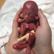 胎儿几周成人形（胎儿几周成人形后还会致畸吗）