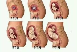 怀得高和怀得低的区别,胎儿怀的下有什么需要注意的
