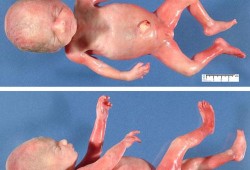 25周胎儿图（孕25周胎儿b超图是怎样的呢，是不是就蜷缩成一团呢，能不能看到脸呢）