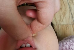 宝宝的上嘴唇越长越厚怎么回事,胎儿上唇显示不清什么原因