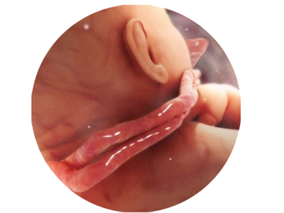 胎儿脐带绕颈一周（脐带绕颈一周应该注意什么）  第3张