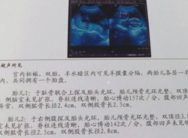 胎儿b超数据标准对照表（胎儿侧脑室宽度正常值是多少）  第2张
