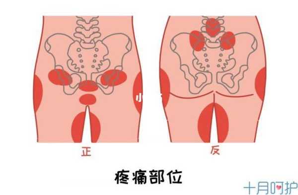 孕期屁股疼（孕妇臀部疼痛是怎么回事）  第3张
