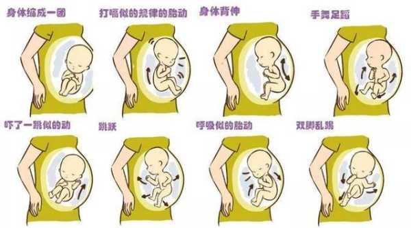 孕晚期宝宝还会发生畸形吗,畸形胎儿会有胎动吗  第1张