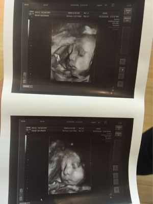 29周胎儿图片（29周胎儿图片真实）  第2张