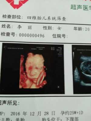 四维检查结果正常，但是宝宝脸上有东西是什么,四维图片胎儿全图  第2张