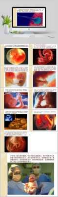 胎儿每个月（胎儿每个月发育过程图）  第2张