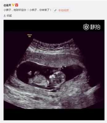 怀孕三个月了，b超显示宝宝偏小，以后会不会有影响,产检胎儿偏小一周怎么办  第3张