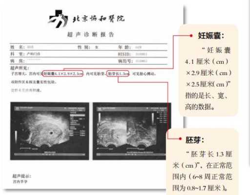 怀孕8周b超图胎儿胎心多少才正常？每次孕检都能听到宝宝心跳,7周胎儿心跳多少正常  第2张